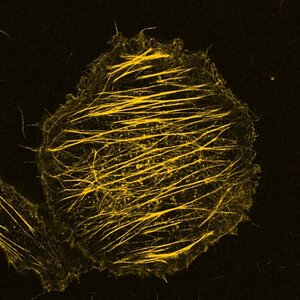 Concours photos ICSN 2025,  Analyse du réseau d'actine par immunofluorescence d'une lignée du cancer de sein triple négatif en microscopie confocale